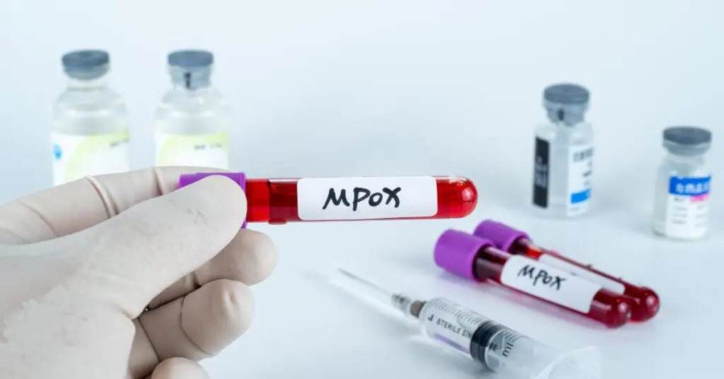 Variole du singe – Mpox: le système de santé français placé en « état de vigilance maximale »