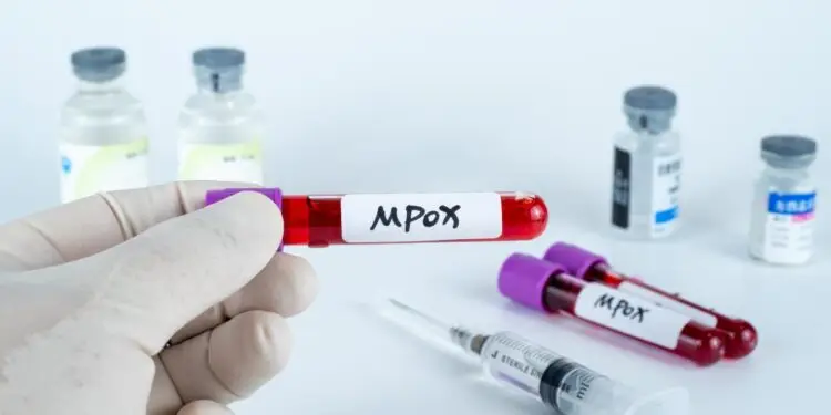 Occitanie : où faire un vaccin préventif contre le virus Mpox ?