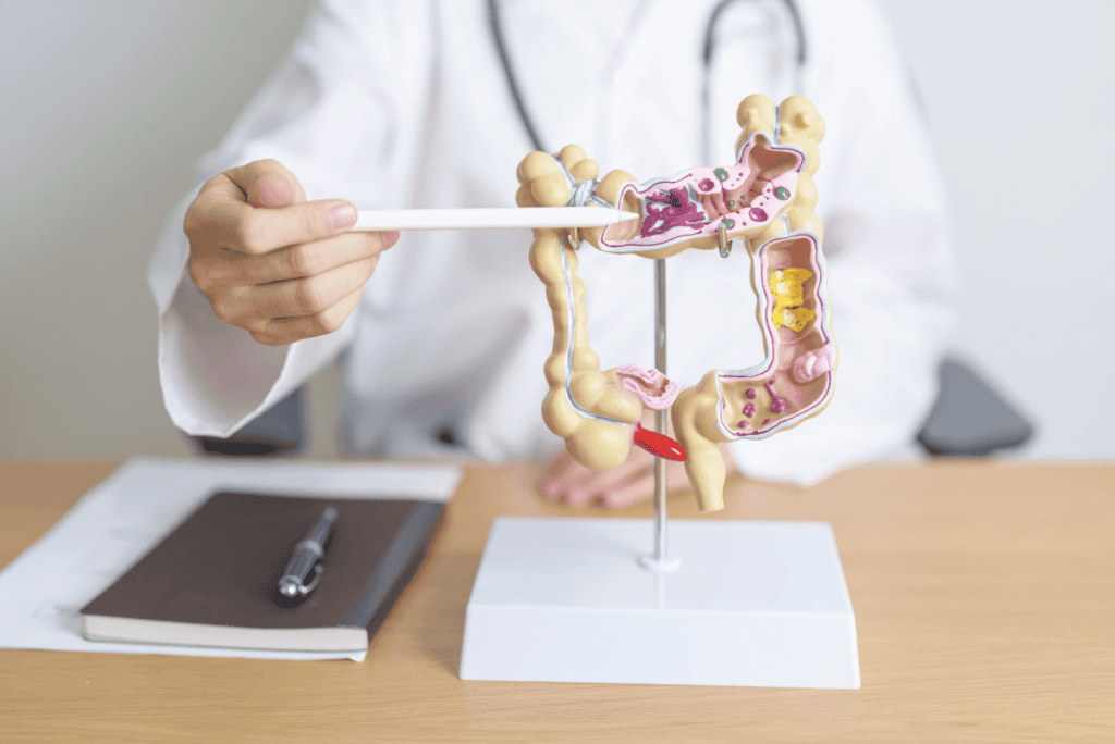 Carcassonne : une journée de sensibilisation au dépistage du cancer colorectal